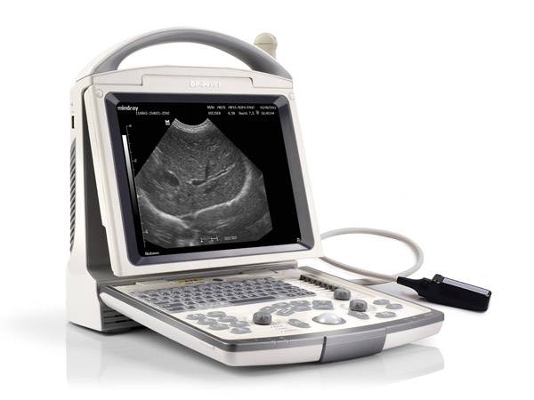 Klinika e Reumatologjisë pajiset me ultrazë