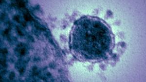 Franca në alarm nga zbulimi i një virusi të ri vdekjeprurës