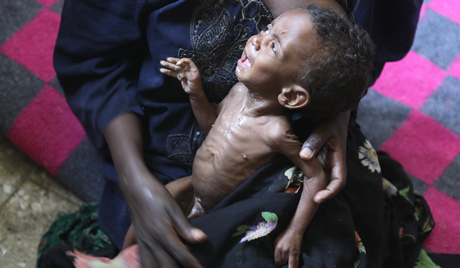 Rreth 15 milionë njerëz vuajnë nga uria në Savanë të Afrikës