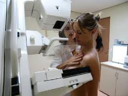 Mosha mesatare e grave të diagnostikuara me kancer të gjirit është 48 - 54 vjeç
